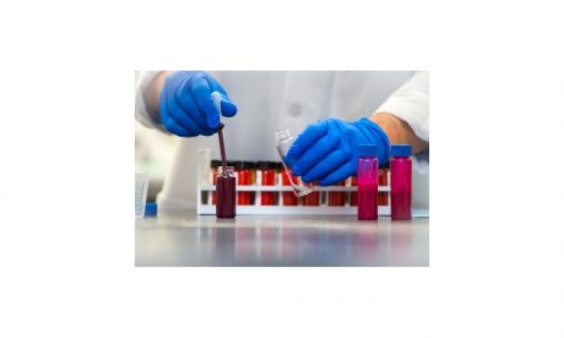 エボニック，分散練合助剤の新製品を発売